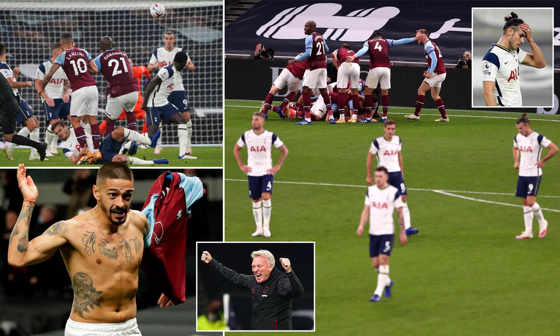 上视野方面 上视野方面